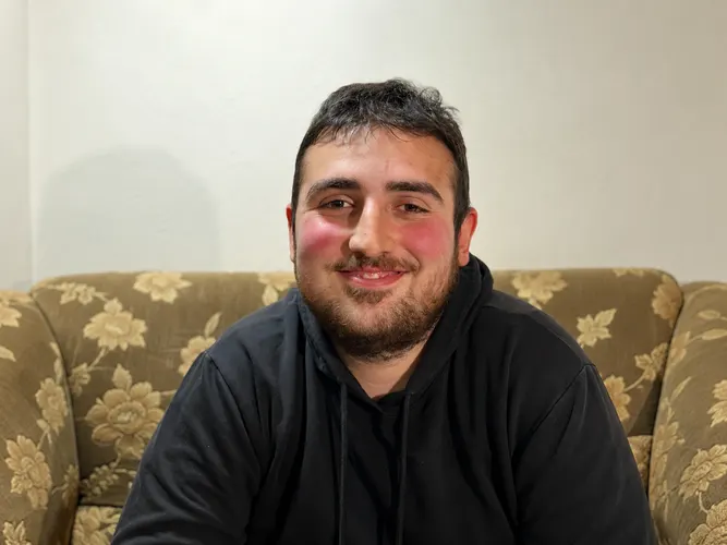 Edgar once again needs our support: he needs membrane plasmapheresis sessions